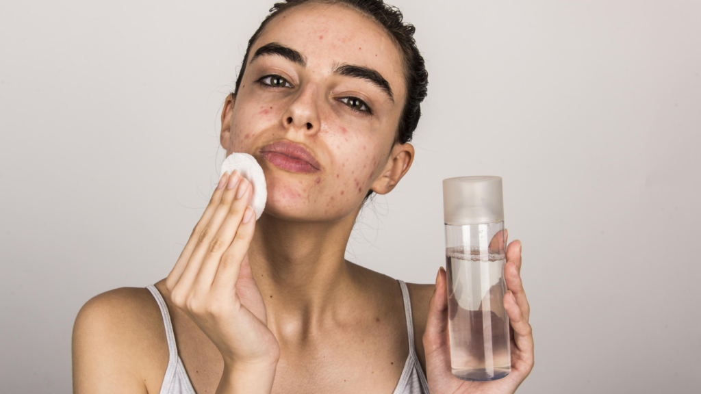 Skincare Routine For Oily Skin And Acne Scars